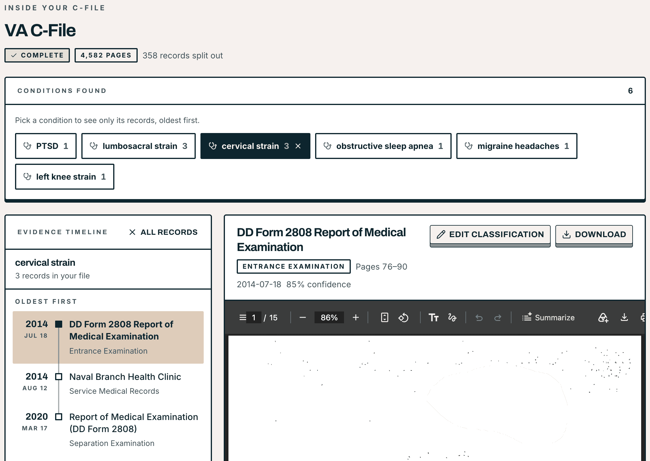 The VeteranAI C-File Analyzer on a real veteran's file: complete, 4,582 pages read and 358 records split out, six conditions found. Cervical strain is selected, and its evidence timeline lists the three records in the file that document it, oldest first: a DD Form 2808 entrance examination from July 18, 2014, Naval Branch Health Clinic service medical records from August 12, 2014, and a DD Form 2808 separation examination from March 17, 2020. The first is open, cited to pages 76 to 90.